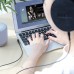 Аудио кабель Aux Hoco UPA14 (2m) (00000035249_1)